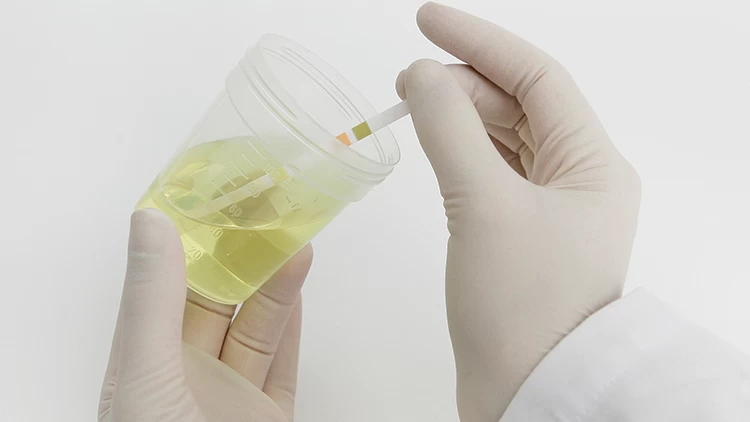 Roche Combur 3 E Teststrips - 50 Stuks 3 Roche Combur 3 E Teststrips - 50 Stuks - Afbeelding 3