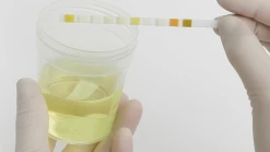 Roche Combur 3 E Teststrips - 50 Stuks 8 Roche Combur 3 E Teststrips - 50 Stuks -Medische Benodigdheden roche combur 3 e teststrips 50 stuks 2